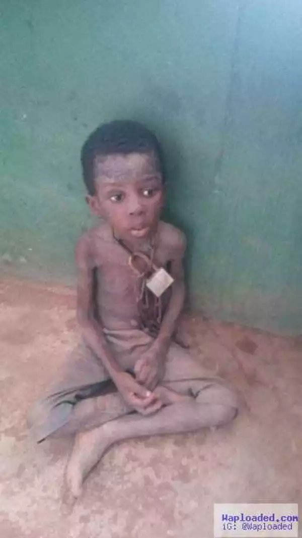 OMG! Malnourished little boy rescued after he was chained in a Celestial church for weeks (photos)